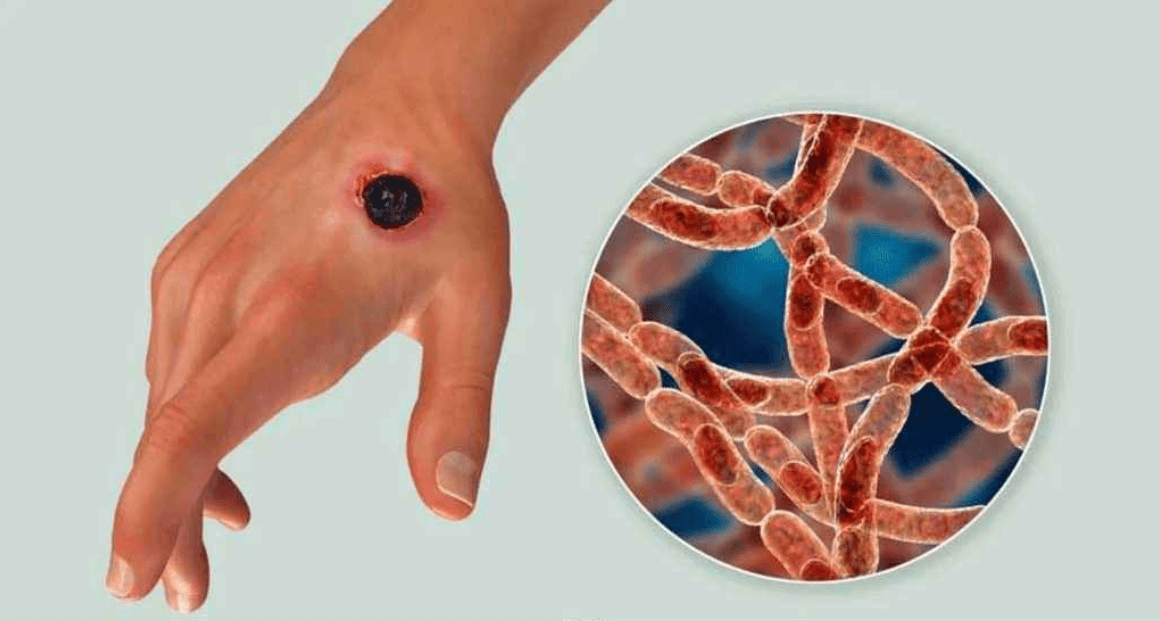 Potato export image showing many potatoes